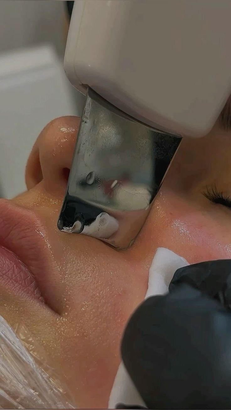 تنظيف بشرة هايدر فيشل Hydrafacial 
